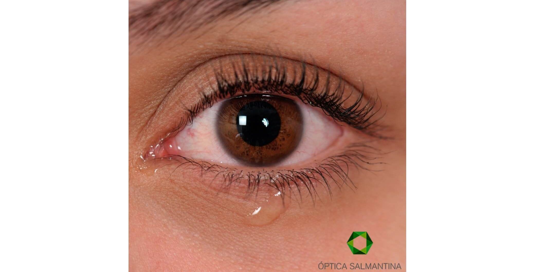 por qué lloran los ojos